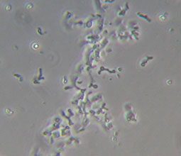Bifidobakterier i mikroskop