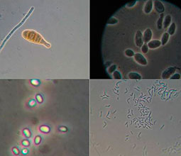Mikroorganismer i mikroskop.